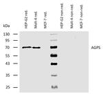 AGPS Antibody in Western Blot (WB)