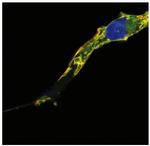 RRAS2 Monoclonal Antibody (EM-50)