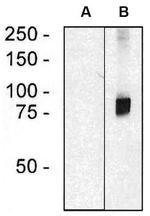 ARHGEF4 Monoclonal Antibody (ARHGEF-08)