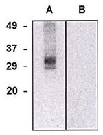 CLIC5 Monoclonal Antibody (CLIC5-02)