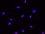 ABHEB Recombinant Rabbit Monoclonal Antibody (002)
