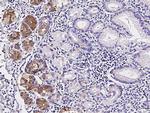 ACOX1 Antibody in Immunohistochemistry (Paraffin) (IHC (P))