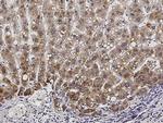 ACOX1 Antibody in Immunohistochemistry (Paraffin) (IHC (P))