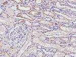 ACOX1 Antibody in Immunohistochemistry (Paraffin) (IHC (P))