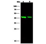 ACVRL1 Recombinant Rabbit Monoclonal Antibody (124)