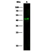 Aminoacylase Monoclonal Antibody (7A11C6C2)
