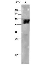 ALDH3A1 Recombinant Rabbit Monoclonal Antibody (316)