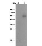 ALDH7A1 Monoclonal Antibody (04)