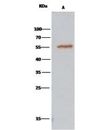 ALDH7A1 Antibody in Immunoprecipitation (IP)