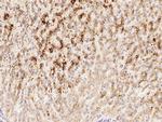 alpha-1 Microglobulin Monoclonal Antibody (11)