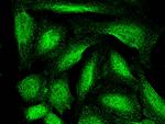 ARL2BP Recombinant Rabbit Monoclonal Antibody (001)