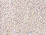 ASGR1 Monoclonal Antibody (02)