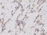 ASGR1 Antibody in Immunohistochemistry (Paraffin) (IHC (P))