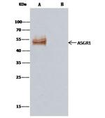 ASGR1 Antibody in Immunoprecipitation (IP)
