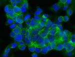 ASGR2 Recombinant Rabbit Monoclonal Antibody (002)