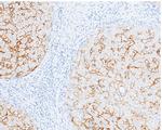 Carbonic Anhydrase XIV Antibody in Immunohistochemistry (Paraffin) (IHC (P))