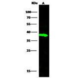 Carbonic Anhydrase VIII Recombinant Rabbit Monoclonal Antibody (008)