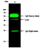 Carbonic Anhydrase IX Antibody in Immunoprecipitation (IP)