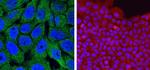 Caspase 14 Monoclonal Antibody (05)