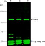 CD19 Antibody in Immunoprecipitation (IP)
