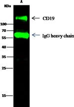 CD19 Antibody in Immunoprecipitation (IP)