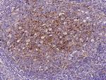 CD200 Antibody in Immunohistochemistry (Paraffin) (IHC (P))