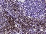CD3d/CD3e Antibody in Immunohistochemistry (Paraffin) (IHC (P))