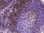 CD3d/CD3e Antibody in Immunohistochemistry (Paraffin) (IHC (P))