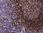CD74 Monoclonal Antibody (01)