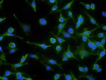 N-cadherin Antibody in Immunocytochemistry (ICC/IF)