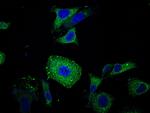 CEACAM6 Antibody in Immunocytochemistry (ICC/IF)