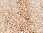 Tetranectin Antibody in Immunohistochemistry (Paraffin) (IHC (P))
