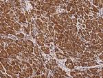 CLPS Antibody in Immunohistochemistry (Paraffin) (IHC (P))