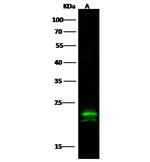 CMPK1 Monoclonal Antibody (08)