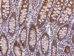 COMMD9 Recombinant Rabbit Monoclonal Antibody (002)