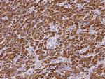 Carboxypeptidase A1 Monoclonal Antibody (03)