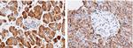 Carboxypeptidase A2 Monoclonal Antibody (02)