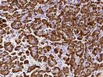 Carboxypeptidase B1 Monoclonal Antibody (07)