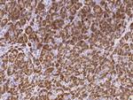 Carboxypeptidase B1 Recombinant Rabbit Monoclonal Antibody (329)