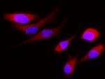 Cystatin S Recombinant Rabbit Monoclonal Antibody (006)