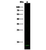 Cystatin A Recombinant Rabbit Monoclonal Antibody (236)