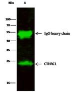 CTHRC1 Antibody in Immunoprecipitation (IP)