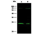 CTHRC1 Recombinant Rabbit Monoclonal Antibody (166)