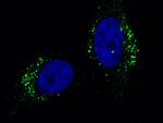 Cathepsin A Recombinant Rabbit Monoclonal Antibody (104)