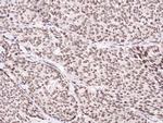 CUEDC2 Recombinant Rabbit Monoclonal Antibody (003)