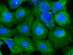DARS Monoclonal Antibody (03)