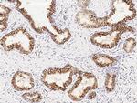 ENTPD5 Monoclonal Antibody (19)