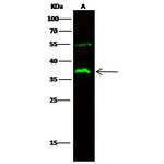 FCGR2A Recombinant Rabbit Monoclonal Antibody (020)
