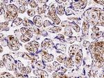 FOLR2 Recombinant Rabbit Monoclonal Antibody (001)