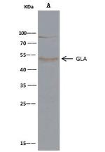 alpha Galactosidase Recombinant Rabbit Monoclonal Antibody (001)
